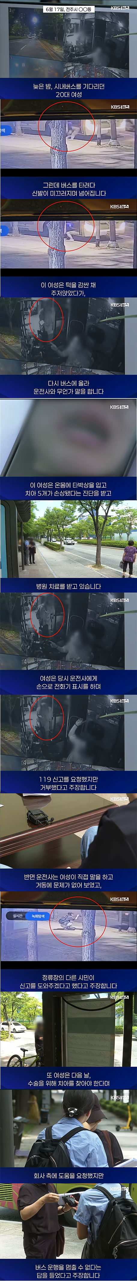 1 복사.png 버스타려다 넘어져서 이빨다친 여성 버스회사에 항의