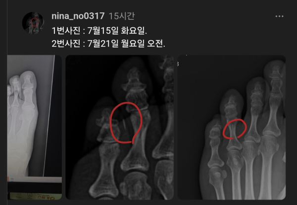 IMG_4014.png 실시간 속보) 한의사와 환자사이에 캐삭빵 오픈!