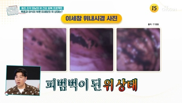 배우 이세창(56)이 과거 폭식과 폭음으로 위 상태가 심각했다고 털어놨다./사진=TV조선 '퍼펙트 라이프'