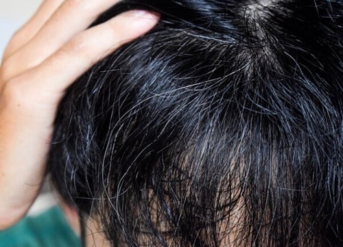 암을 막은 흔적일수도